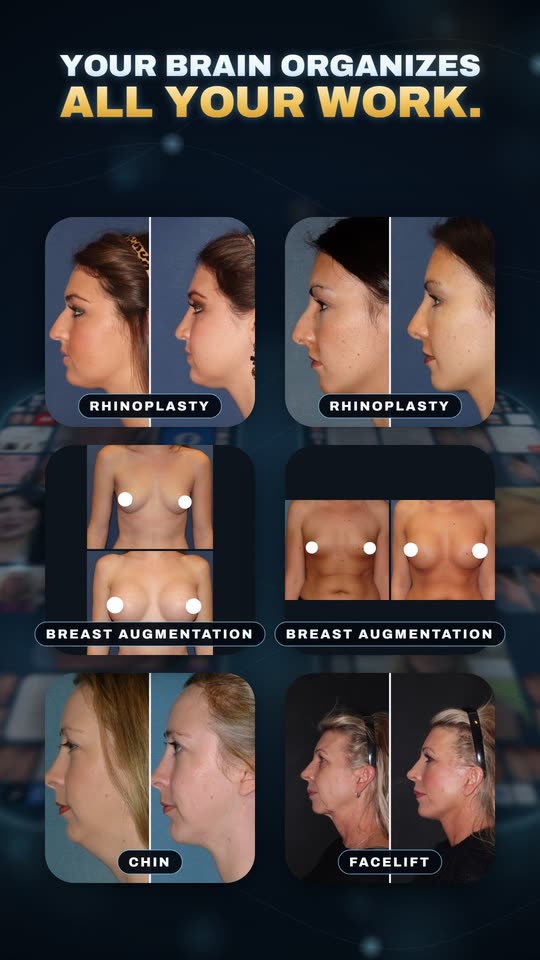Before and after cases sorted by procedure