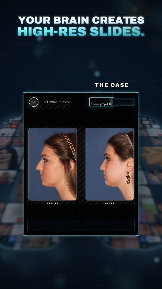 A case built into a high-resolution slide