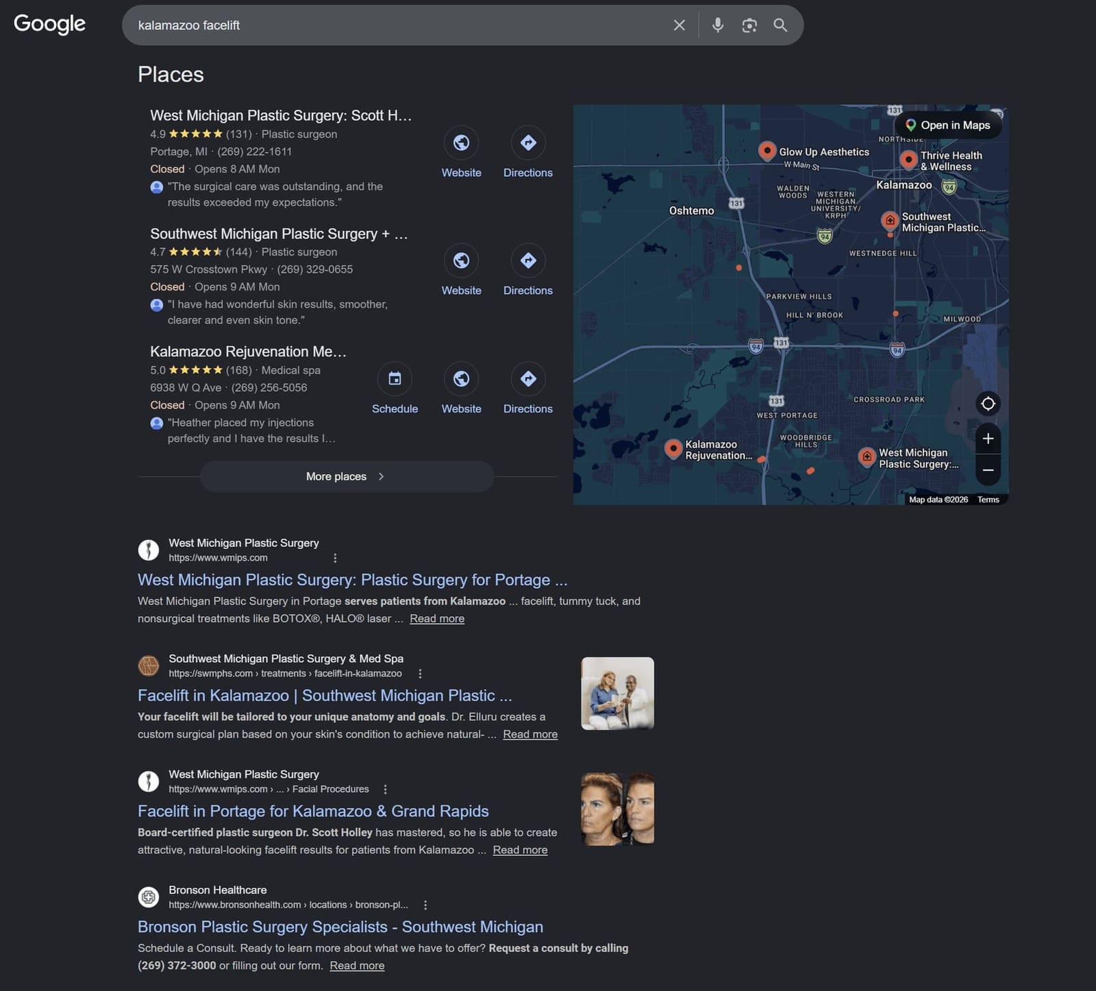 Google map pack with West Michigan Plastic Surgery ranked first for kalamazoo facelift
