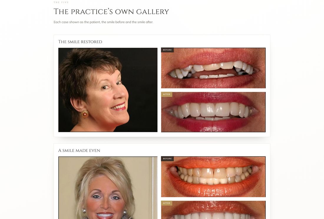 New smile gallery page, desktop