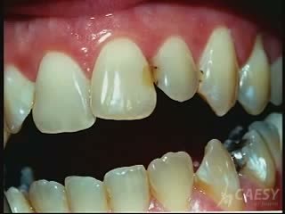 Frame from the old site's dental floss video