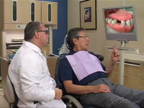 Frame from the old site's bridges, named for a roseville dentist video