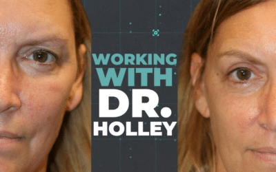 Revolutionizing Rhinoplasty with a Video-First Strategy!